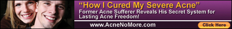 acne treatment banner